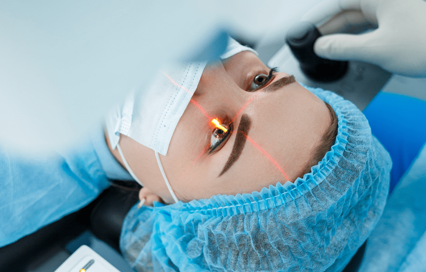 Как появилась лазерная коррекция зрения