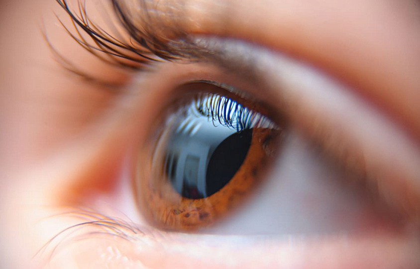 Катаракта простыми словами: что это и как проявляется